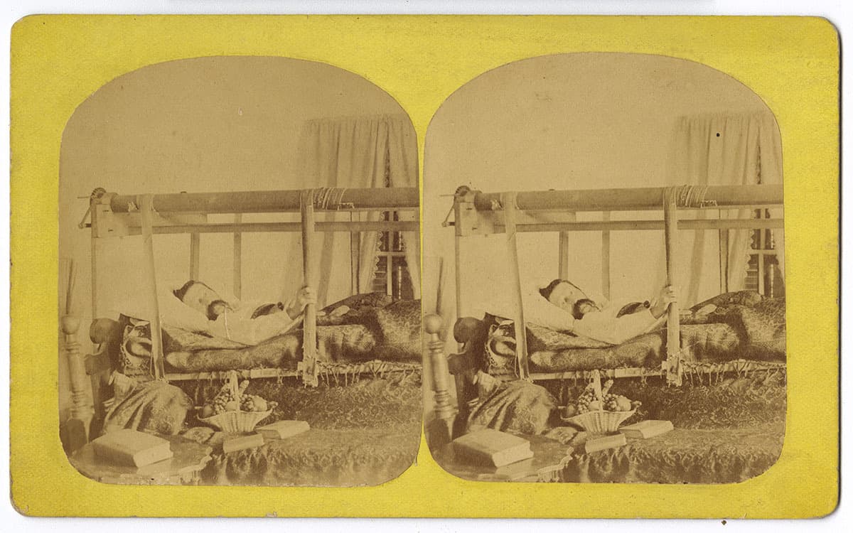 [Man lying on a mechanical invalid bed] (United States, ca. 1870). Albumen on stereograph mount.